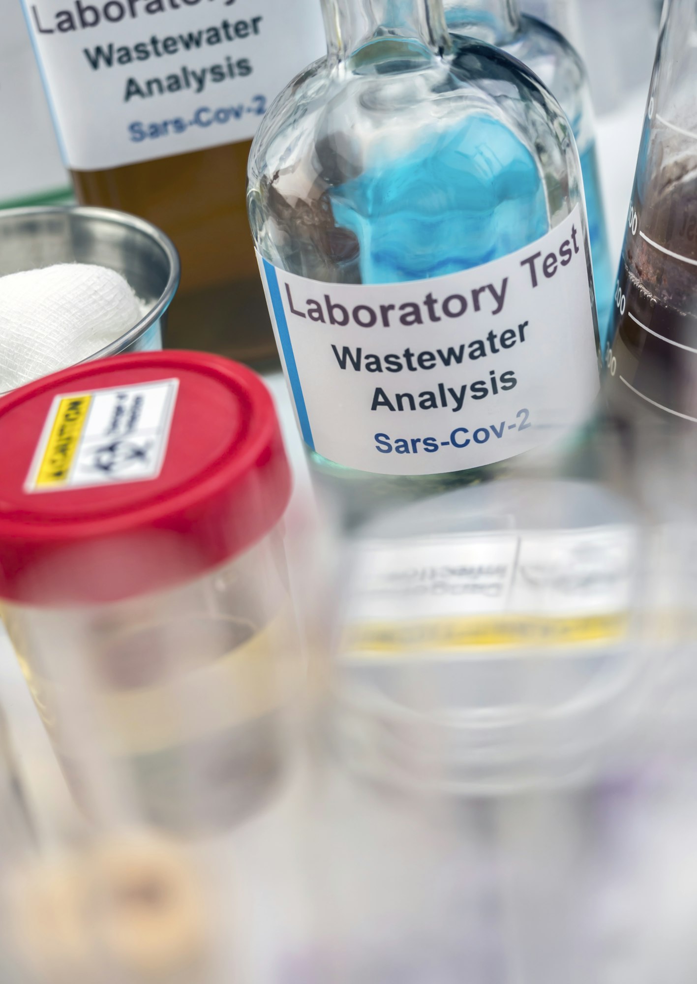 Wastewater samples, analysis of sars-cov-2 virus in patients infected by human coronavirus 229E